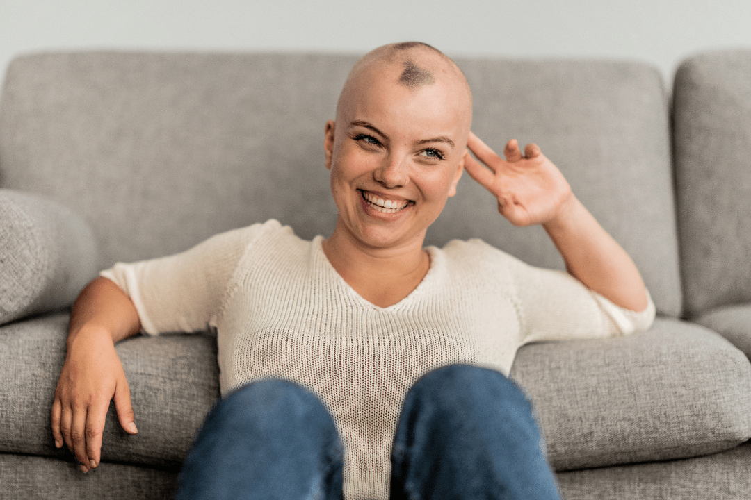 alopecie-pelade-ou-calvitie-precoce